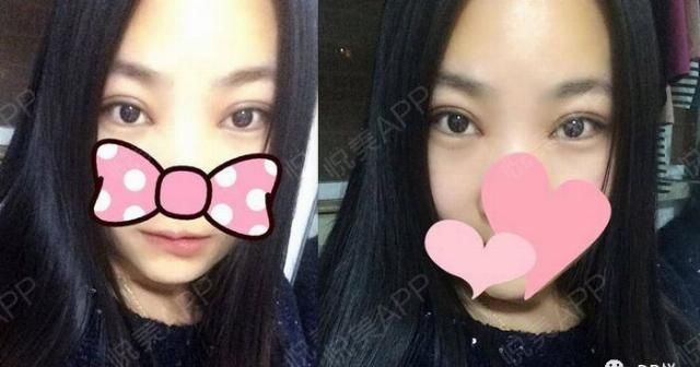 『眼睛』什么样的眼,能成就一张高级脸?|案例