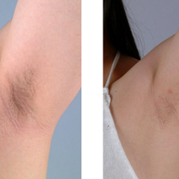 不管男女不要一毛不拔，夏天这几个地方必须弄干净，尤其是女人