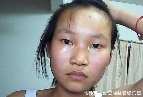  『脸上』青春期女生脸上总“出油”坚持3个好习惯，对“大油田”说拜拜