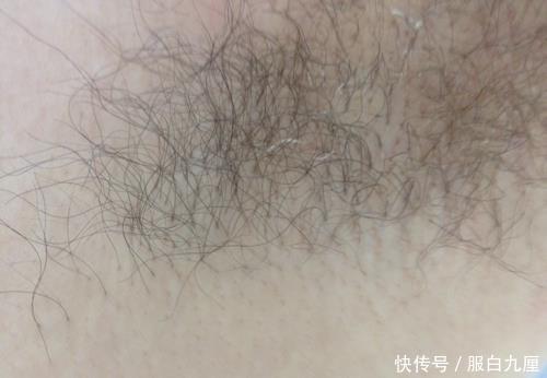 「脱毛」夏季“脱腋毛”,3处的“毛发”要脱干净,美女穿衣服都不尴尬
