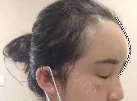  「看起来就」为什么做了整形也没有变好看