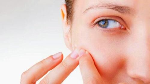  『脸上』脸上总是长脂肪粒怎么办？要不要挤掉？你做对了吗？看专家理解