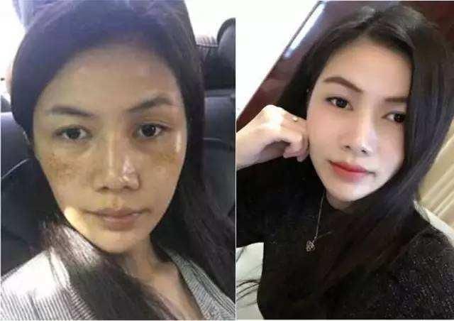 农村常见的车前草，每天这样抹脸，3次美白，七天祛斑很简单