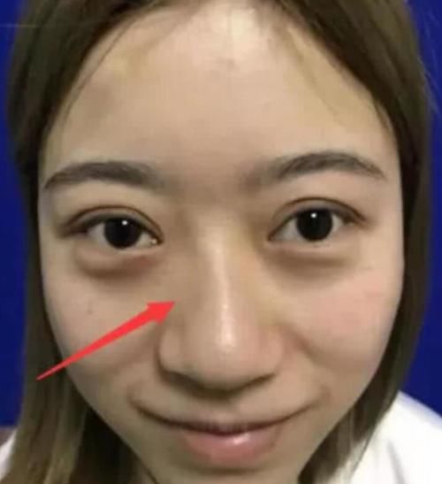  「鼻子」被直男公认的3种“丑鼻子”，颜值再高也白搭，第三最“辣眼睛”