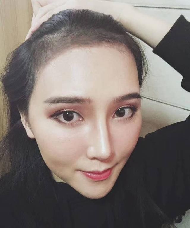  #越高的发际#不想被人叫大长脸，女生发际线高真的没办法吗？