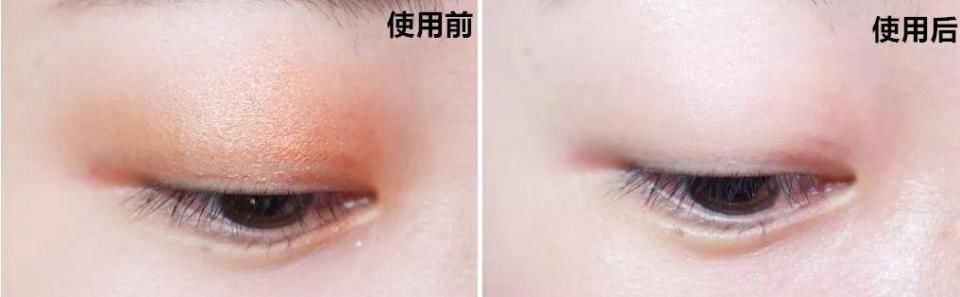 女子25年不卸妆竟长出结石!看完实在令人毛骨悚然……