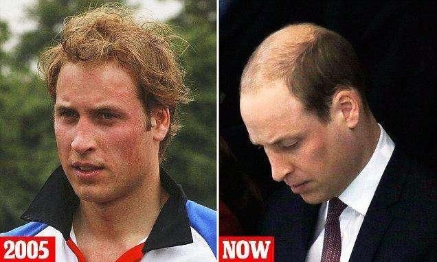 威廉王子是如何一步步演变成“地中海”? 娶凯特时还是金发美男呢