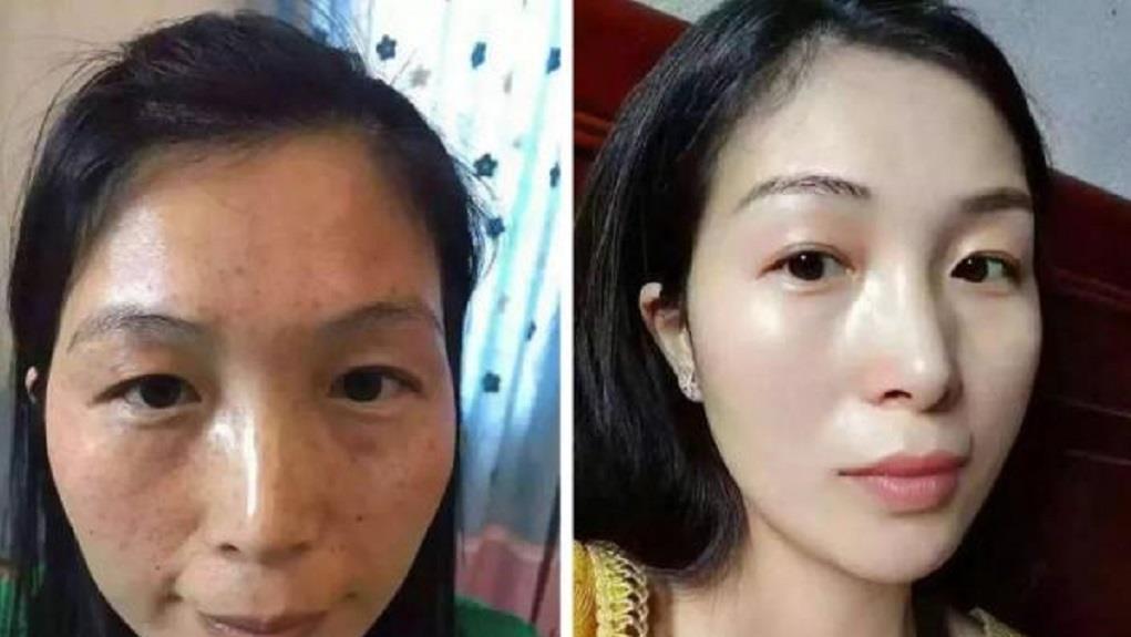  实用：一碗淘米水加它敷敷脸，不出15天色斑淡化又嫩肤，简单实用不花钱