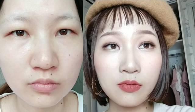 「手术」眼部整形美容——眼周配搭重构,解救四种眼周难题!