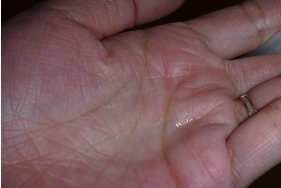 天呐！药店一块钱的它竟比几百块的护肤品还好用，皮肤紧致水嫩