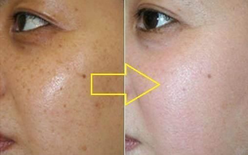 偶然间发现，药店一药膏，淡斑去皱有一手，可惜多数人还傻傻不知