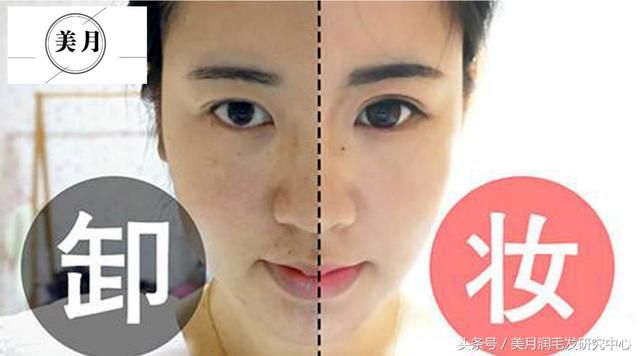 25年不卸妆！女子眼里长结石险失明