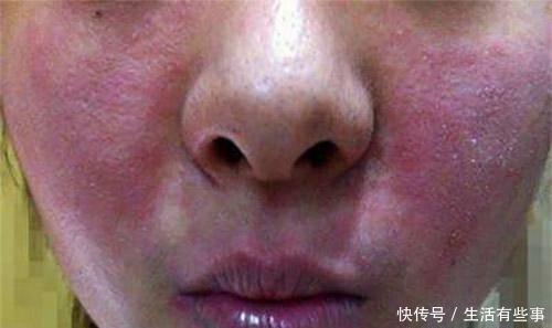 皮肤：香皂洗脸和洗面奶洗脸, 2个月后, 结局大不同!，体验：