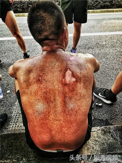 90后消防战士受伤背影刷屏，但你可能被“标题党”骗了