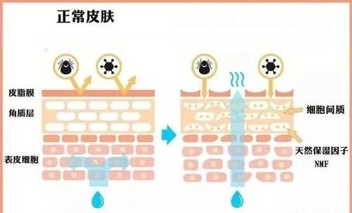  遭遇：干性皮肤遭遇春季干燥，干上加干怎么洗脸，记住三元素和四要素