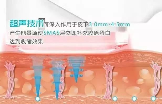 《如懿传》周迅的囧途，你若同有，一步治好!