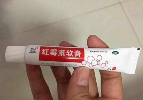 『对淡斑』几毛钱的红霉素软膏成了淡斑专家医生道出了用法和答案