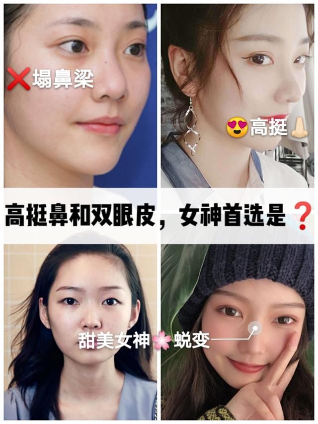 『讲解』决定颜值的是眼睛,还是鼻子?超全讲解在这里
