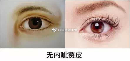  【内眦赘皮矫】需不需要看眼角……请对号入座