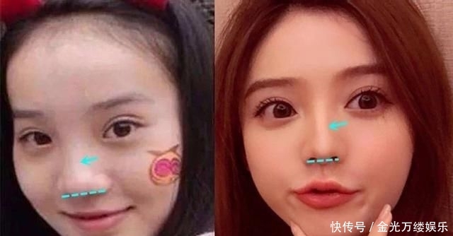  [整坏]susan撬綦美合男友？500w粉丝网红直播假体暴露，夏夏鼻子整坏