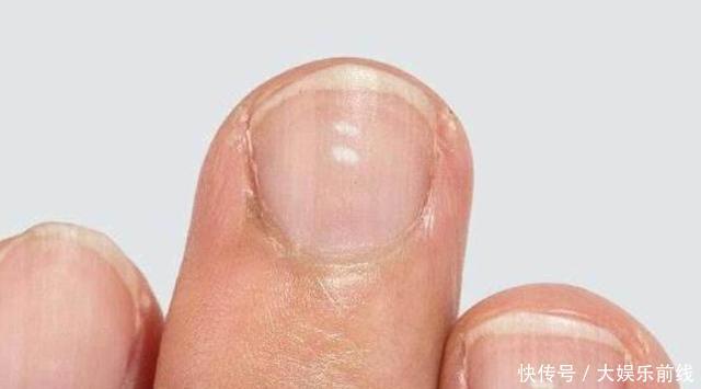 『肝脏出』肝好不好,“竖中指”就知道,身体若无3个表现,还算“肝”净!