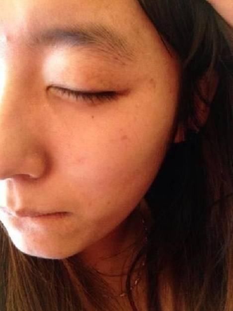 白醋+2+？睡前敷脸竟可以祛斑！三天斑消五天除皱