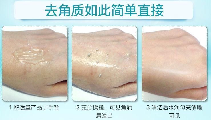 整容遭报应?她的少女脸这么快就烂了?