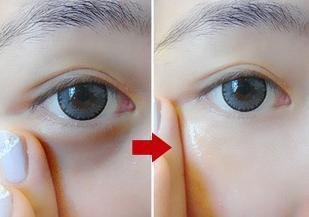 药铺10块多一管的软膏,睡前用来擦眼部,对修复眼袋皱纹很有效