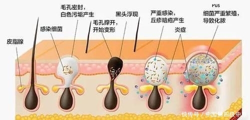 『款洗发』3款容易“踩雷”的洗发水,用后头痒又起头皮屑,没用过真的幸运
