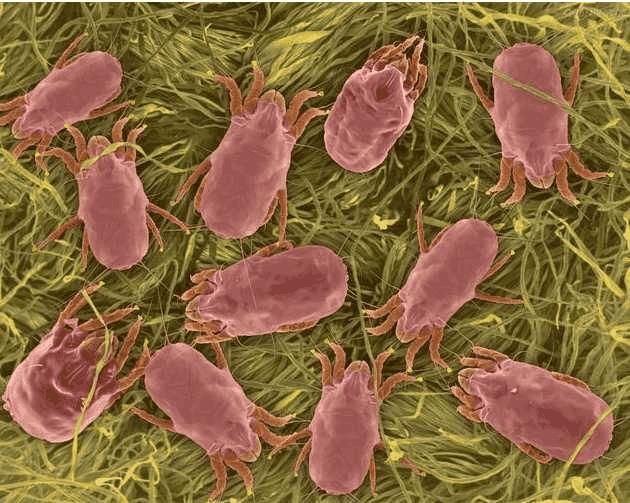 警告：后背有这5个“奇怪的现象”, 是螨虫在向你“打招呼”了