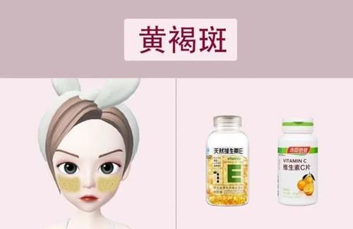  预防：脸上的斑点是如何形成的？看看这4种你有没有，最后一种可预防