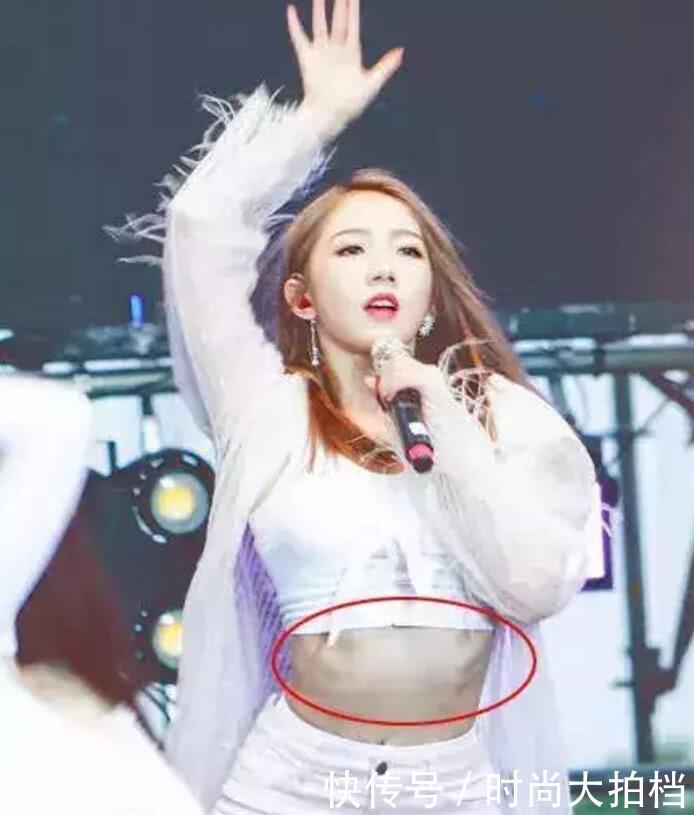 讲真，孟美岐“肋骨外翻”上热搜，其实是众多爱美女孩的高能预警