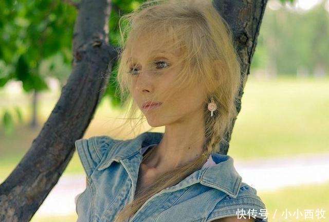 少女因害怕身体走形，每天坚持只喝水不吃食物，如今成“活骷髅”