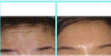 一个女人老不老?只要看这几个地方!女人一定要保养好