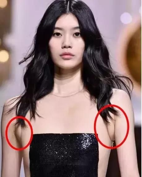 奚梦瑶 T 台走秀又崩了？这个部位不注意，夏天穿衣很尴尬