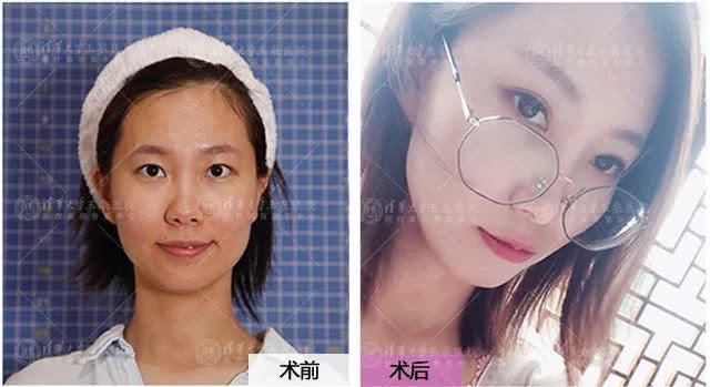  「时代」让眼睛定格美丽，告别“妆修”时代