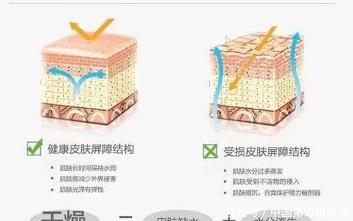 『款洗发』3款容易“踩雷”的洗发水，用后头痒又起头皮屑，没用过真的幸运