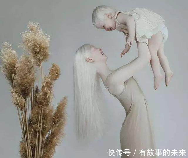 『冷嘲热讽』最“励志”姐妹花,从小饱受冷嘲热讽,如今逆袭成国际超模