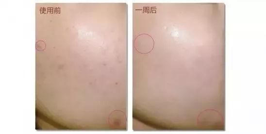 妮姿颜:轻熟龄肌保养有道,素颜女神宋智孝有话要说!