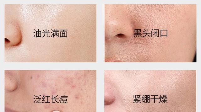 『皮肤』用了劣质洗面奶洗脸会“烂脸”?那是你没选对洗面奶,一错毁所有