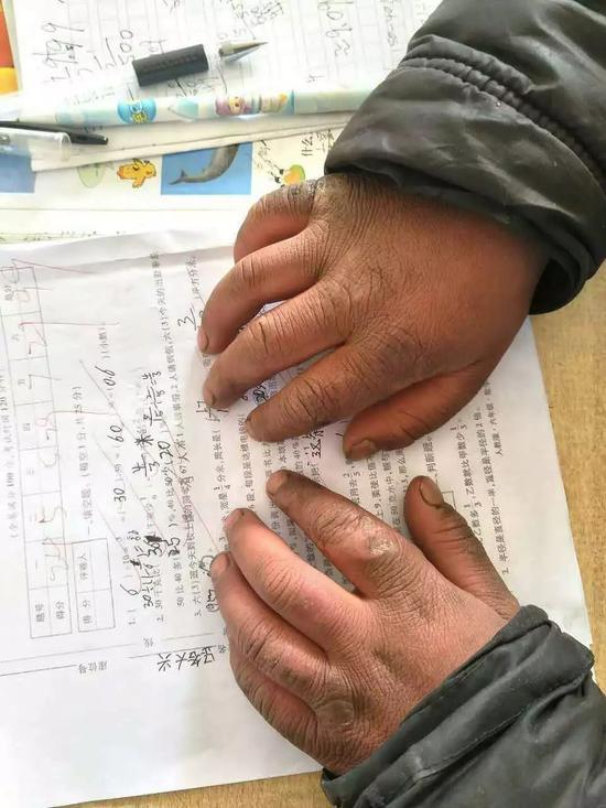 还记得惊动省长的“冰花男孩”吗?他的日子大变样