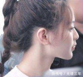 鼻子■鞠婧祎这是第几次do鼻子了?还没消肿就走红毯意外艳压全场!