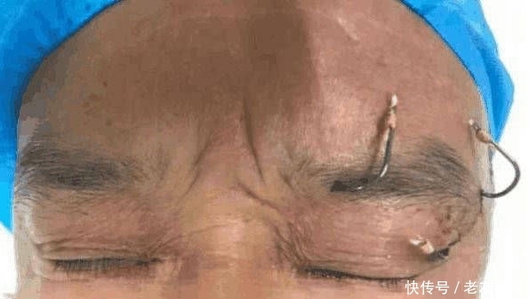 【钓友】钓鱼到底会伤眼睛吗?一直是个存在争议的话题