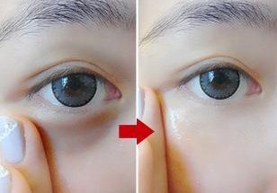 忠告:女人一旦有法令纹，别打玻尿酸!学下面女人一招，轻松去纹