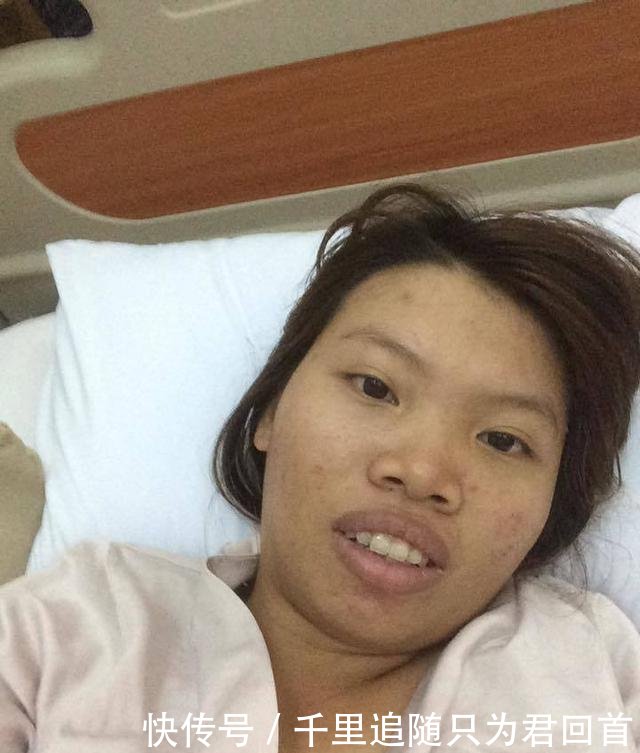 漂亮：从丑女变成漂亮女神，嫁给了富二代，21岁丑女花费10万元整容