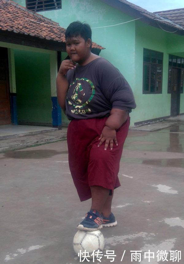 曾经那个世界最胖的男孩！体重384斤，减肥152斤后变帅小伙
