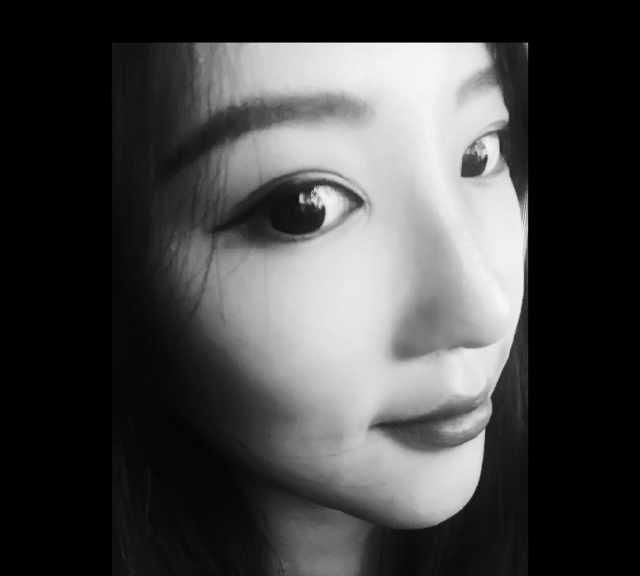  男友@小姐姐被男友带绿帽，分手后立马隆鼻，术后恢复让前任后悔莫及