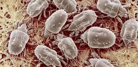 晚上睡觉闭上眼睛,700W螨虫爬过你的脸颊,一