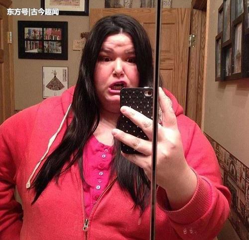 350斤胖妞减掉一半多体重，肚子留下20斤重的赘皮后悔不已！