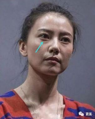 90后的郑爽关晓彤眼袋都要掉地上了，快来个医生救救她们吧!